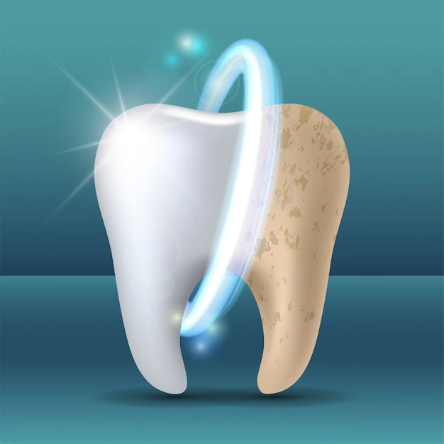 tooth decay detection Whitchurch Hampshire  Poole