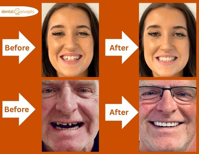 Introducing the Smile Ambassador Programme: Be the Face of a Confident New You 