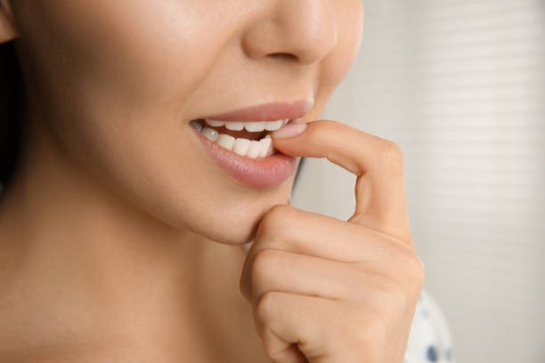 Protect Your Smile: The Impact of Nail Biting on Dental Health