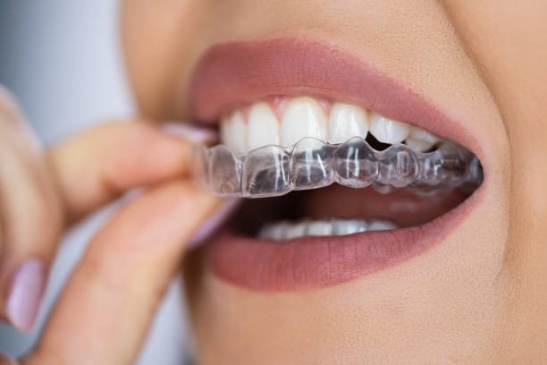 Transform Your Smile with Dental Concepts